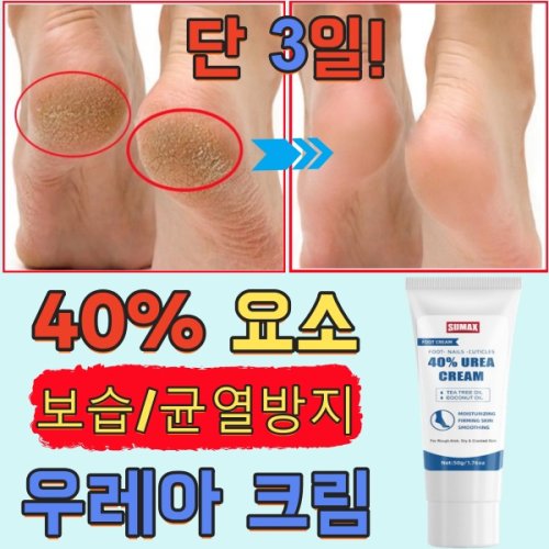 [강보습] 발각질제거 크림 뒷꿈치 유리아 요소 크림 발 갈라짐 인텐스 모이스처 크림 발 갈라짐 방지 고농도 요소 풋크림, 6개